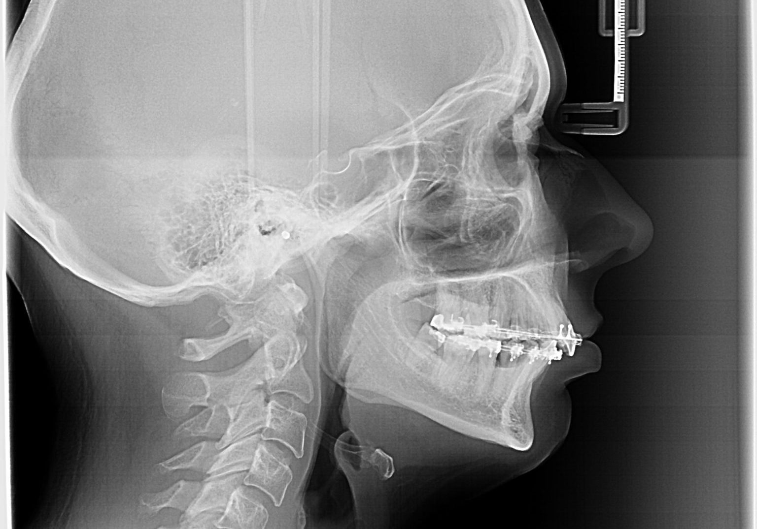 WTIC Oral Pathology