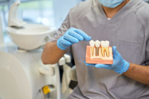 Dental implant